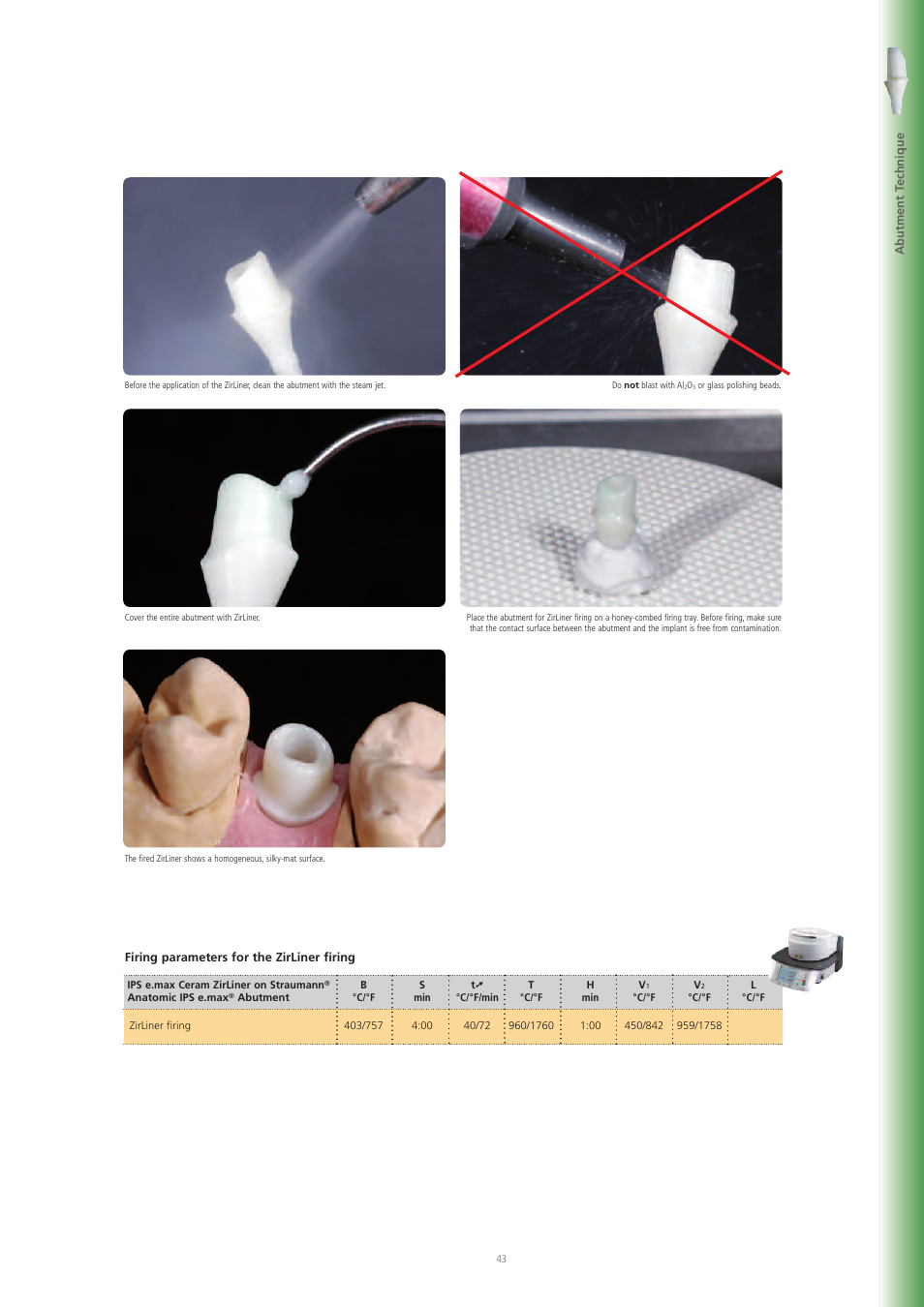 Ivoclar Vivadent IPS e.max Ceram User Manual | Page 43 / 72