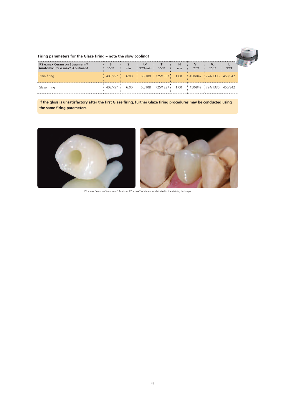 Ivoclar Vivadent IPS e.max Ceram User Manual | Page 48 / 72