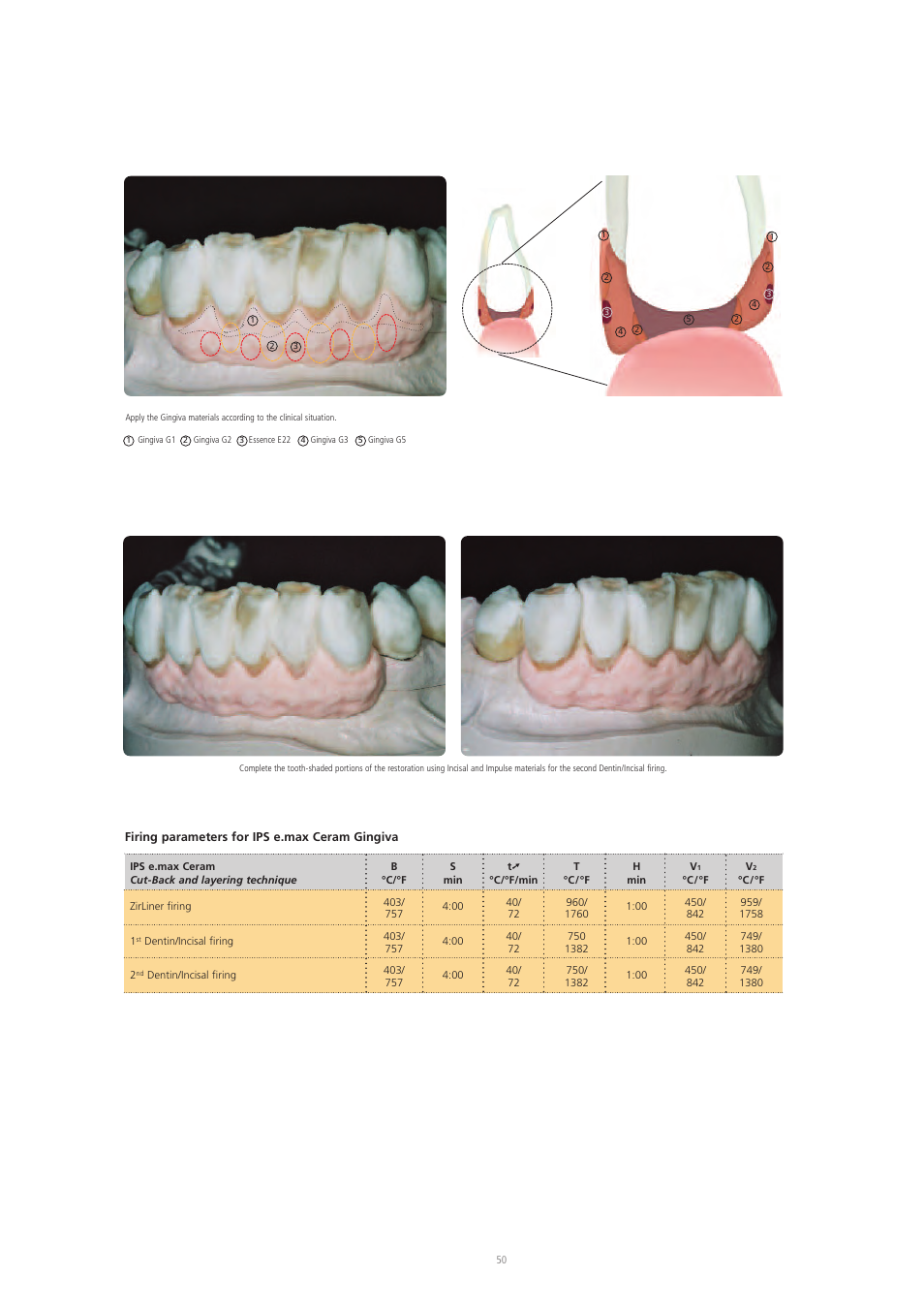 Ivoclar Vivadent IPS e.max Ceram User Manual | Page 50 / 72