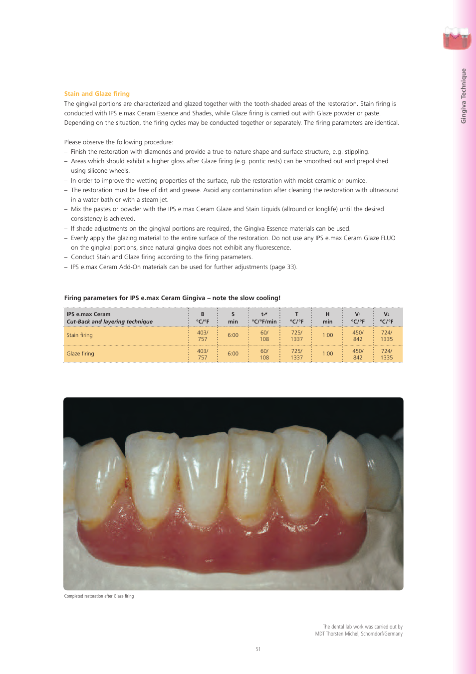 Ivoclar Vivadent IPS e.max Ceram User Manual | Page 51 / 72