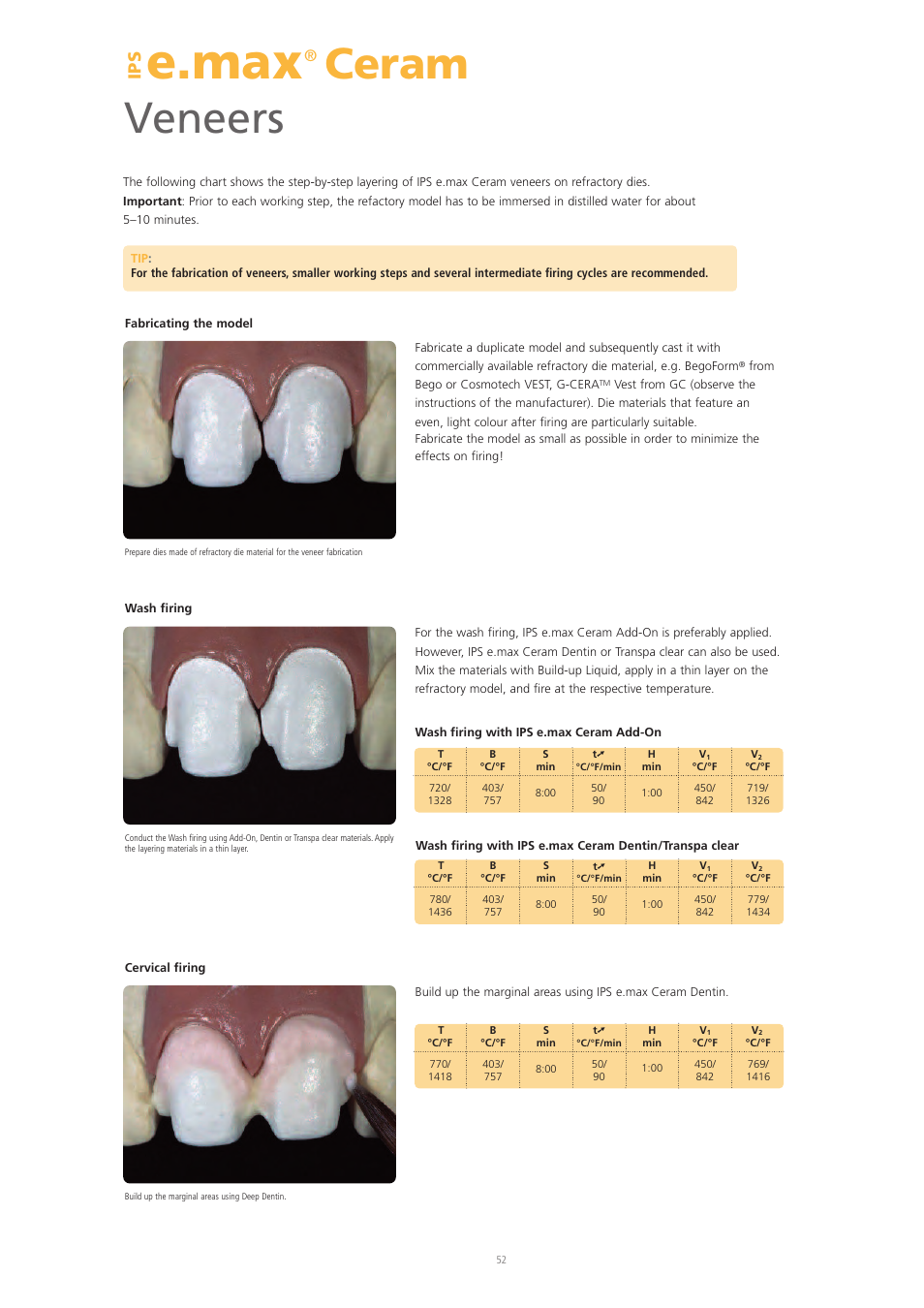 E.max, Ceram veneers | Ivoclar Vivadent IPS e.max Ceram User Manual | Page 52 / 72