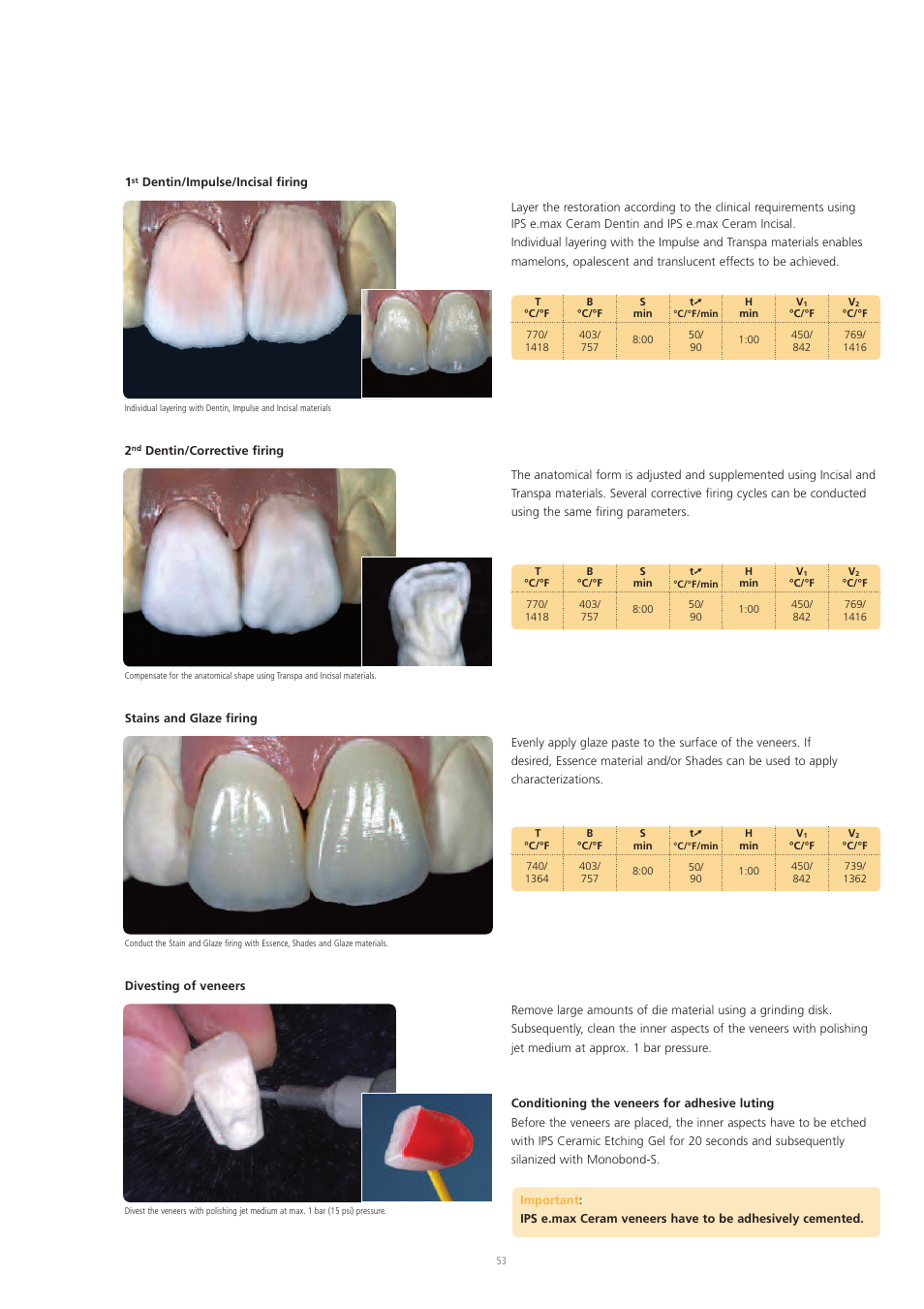 Ivoclar Vivadent IPS e.max Ceram User Manual | Page 53 / 72