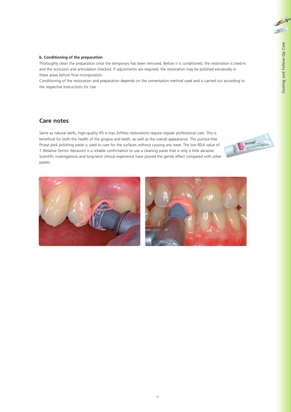 Ivoclar Vivadent IPS e.max Ceram User Manual | Page 61 / 72