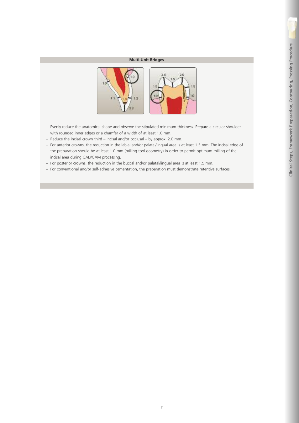 Ivoclar Vivadent IPS e.max ZirPress User Manual | Page 11 / 76