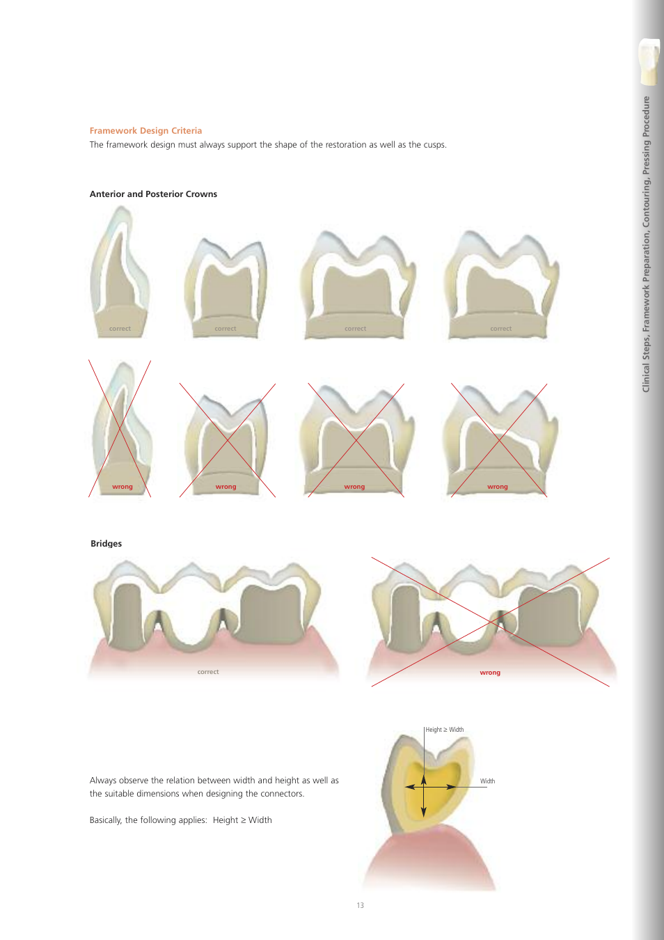 Ivoclar Vivadent IPS e.max ZirPress User Manual | Page 13 / 76