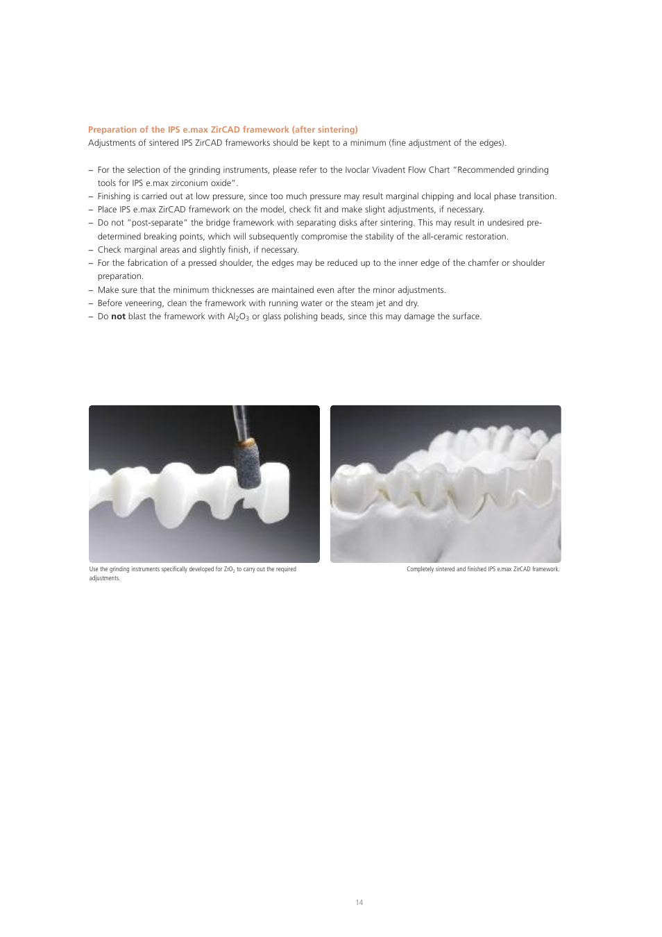 Ivoclar Vivadent IPS e.max ZirPress User Manual | Page 14 / 76