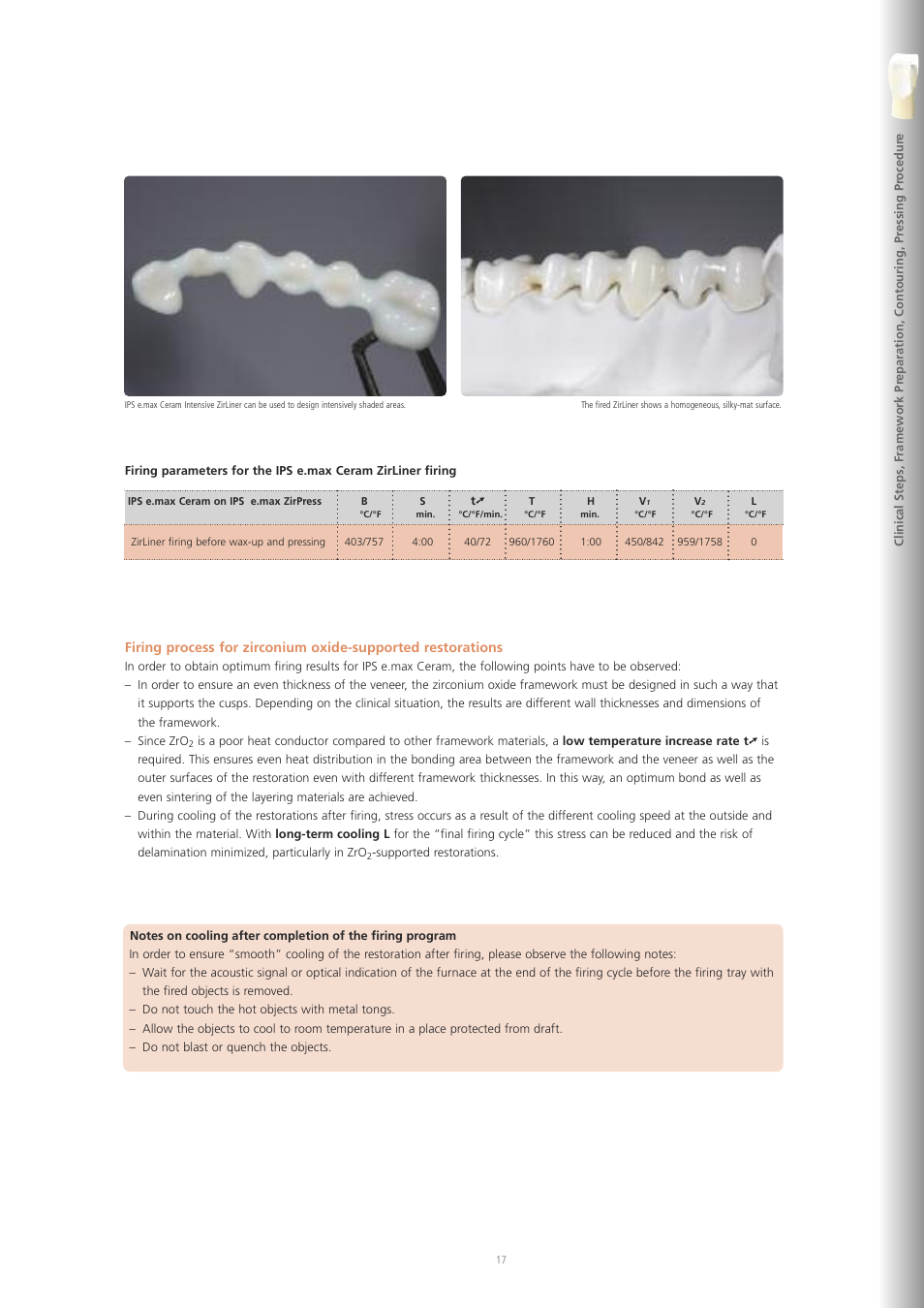 Ivoclar Vivadent IPS e.max ZirPress User Manual | Page 17 / 76