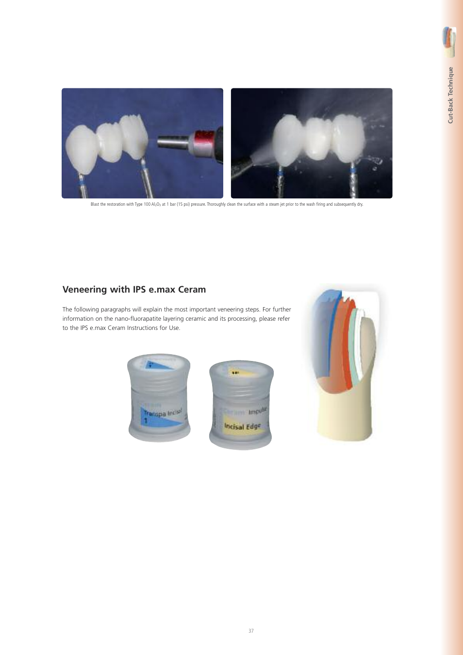 Veneering with ips e.max ceram | Ivoclar Vivadent IPS e.max ZirPress User Manual | Page 37 / 76