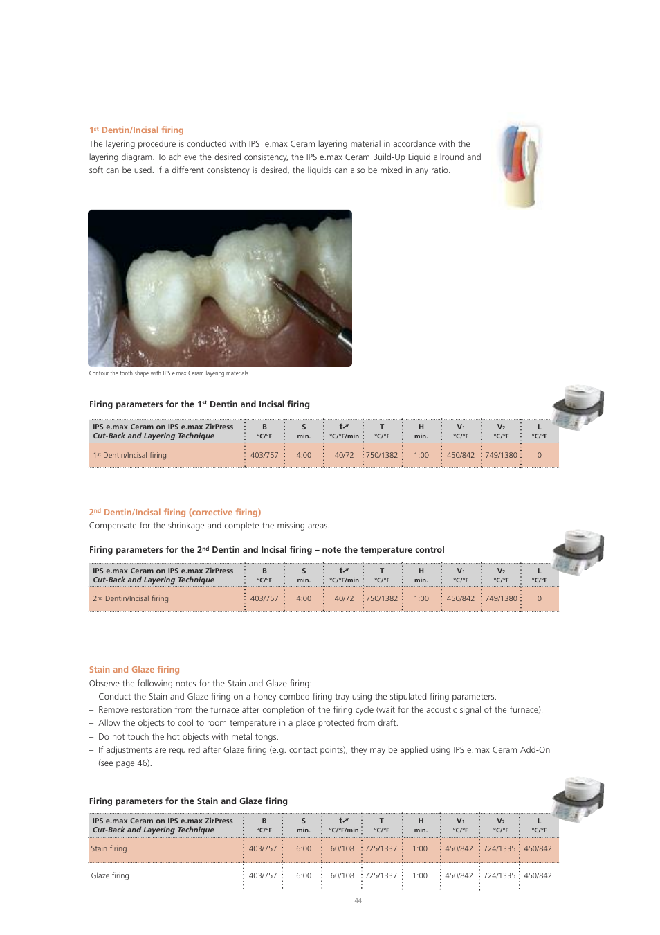 Ivoclar Vivadent IPS e.max ZirPress User Manual | Page 44 / 76