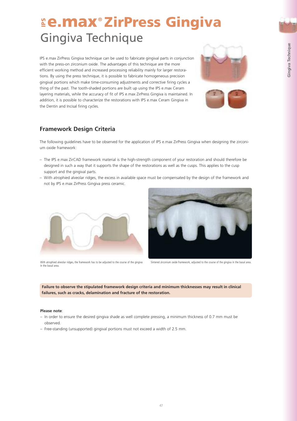 E.max, Zirpress gingiva, Gingiva technique | Framework design criteria | Ivoclar Vivadent IPS e.max ZirPress User Manual | Page 47 / 76