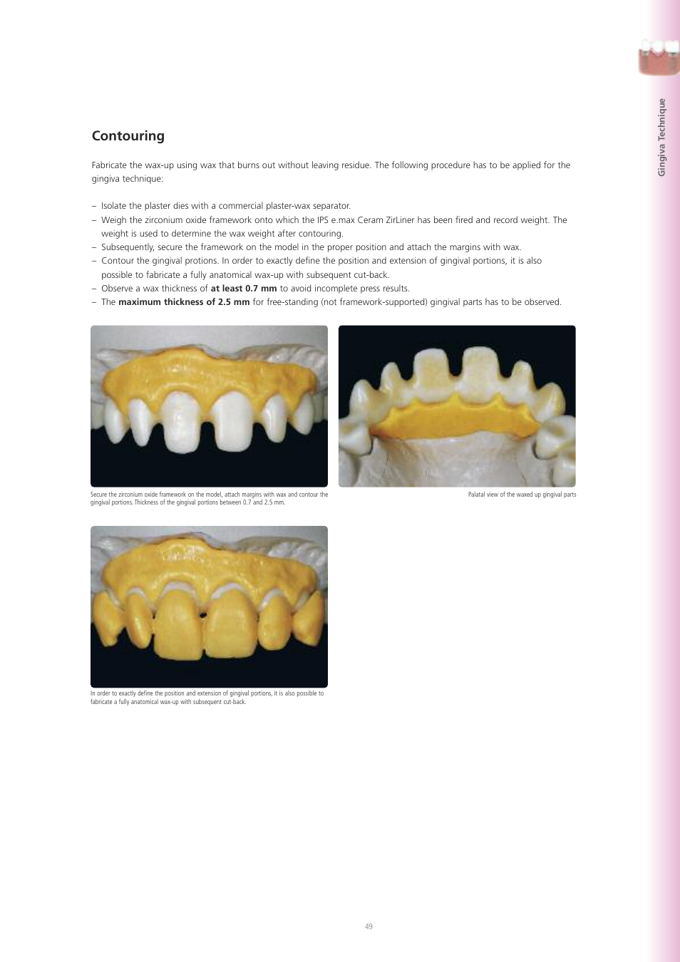 Contouring | Ivoclar Vivadent IPS e.max ZirPress User Manual | Page 49 / 76