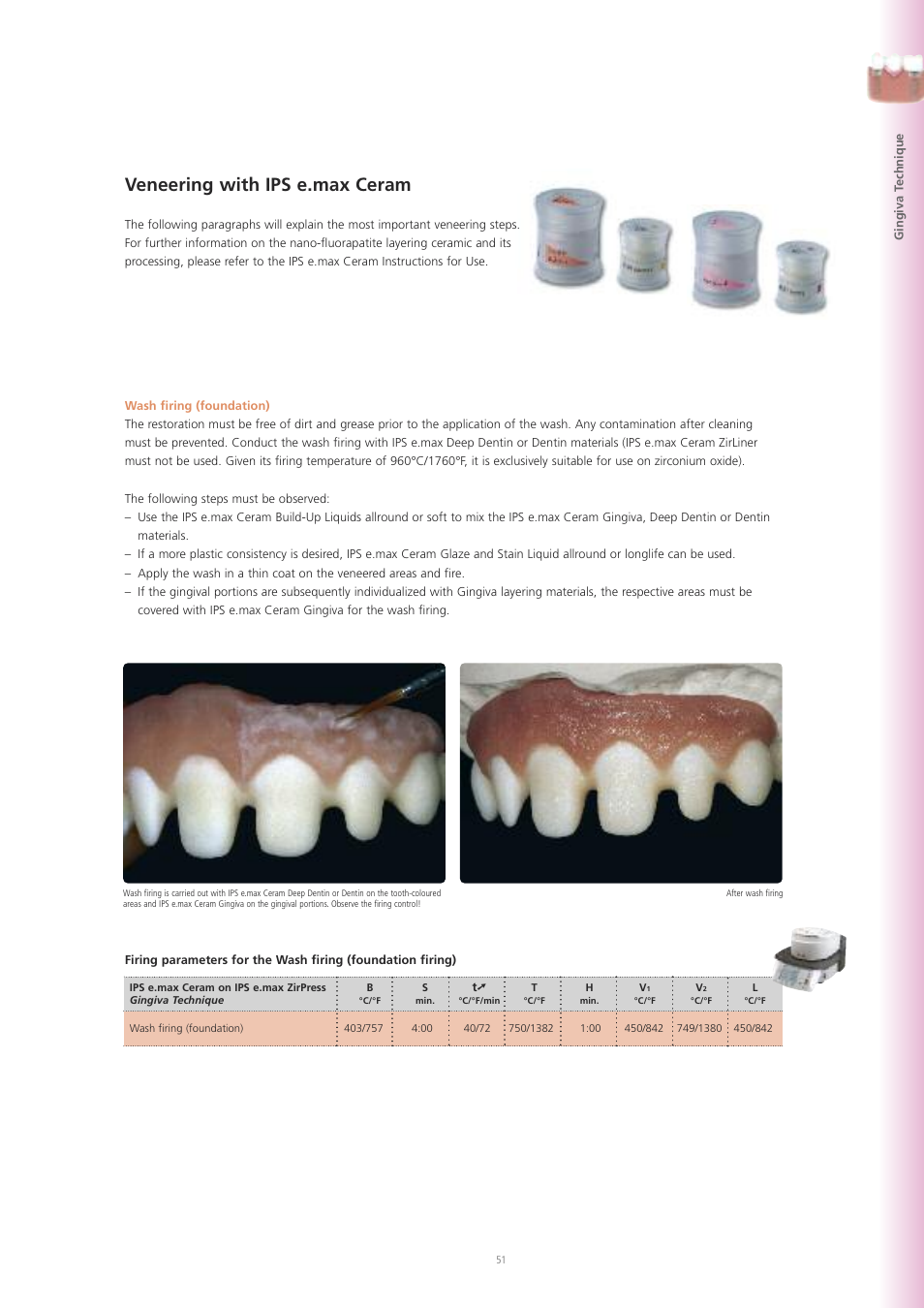 Veneering with ips e.max ceram | Ivoclar Vivadent IPS e.max ZirPress User Manual | Page 51 / 76