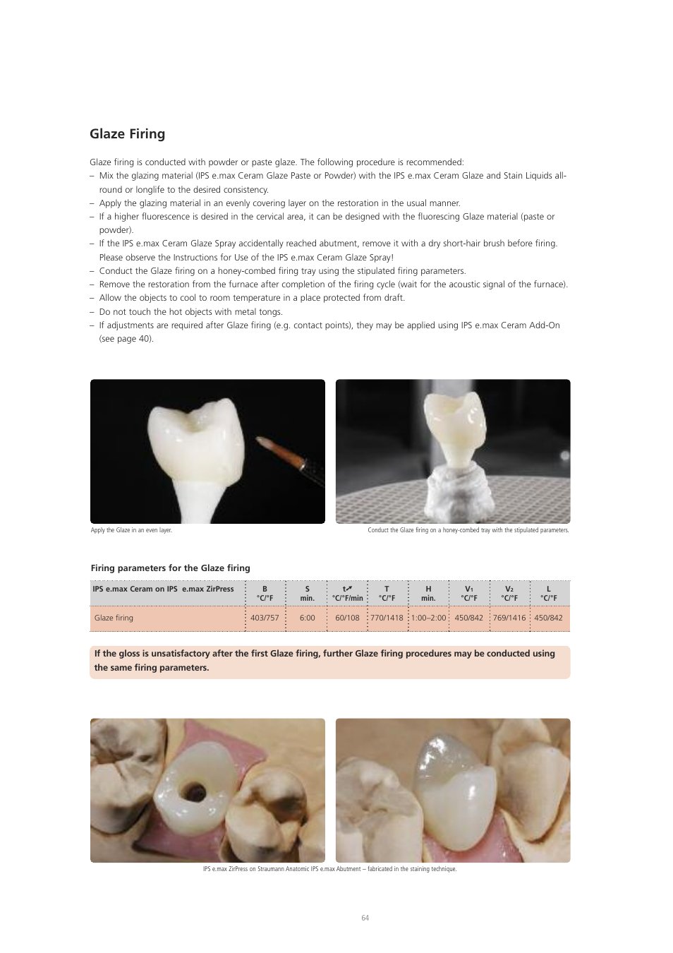 Glaze firing | Ivoclar Vivadent IPS e.max ZirPress User Manual | Page 64 / 76