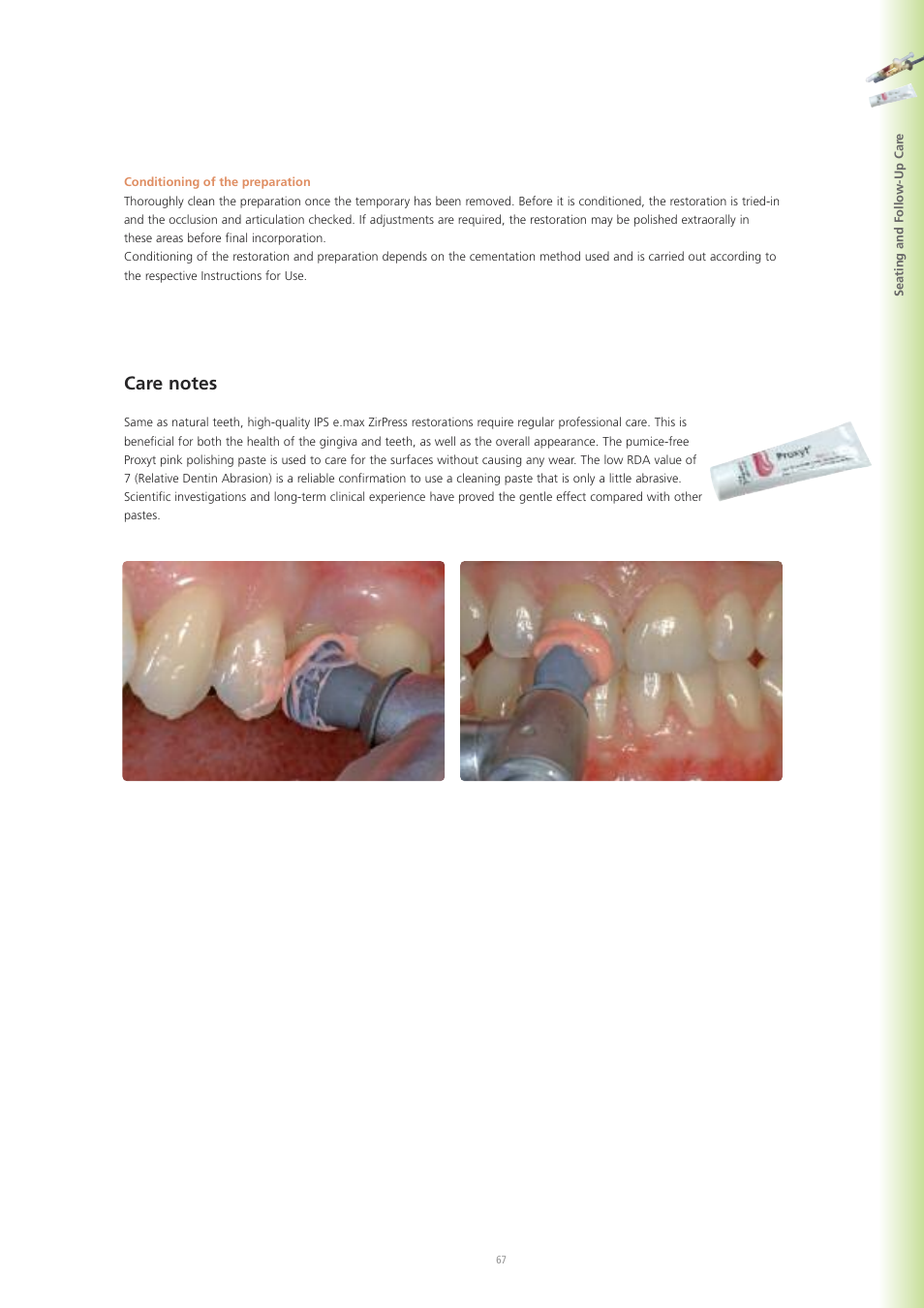 Ivoclar Vivadent IPS e.max ZirPress User Manual | Page 67 / 76