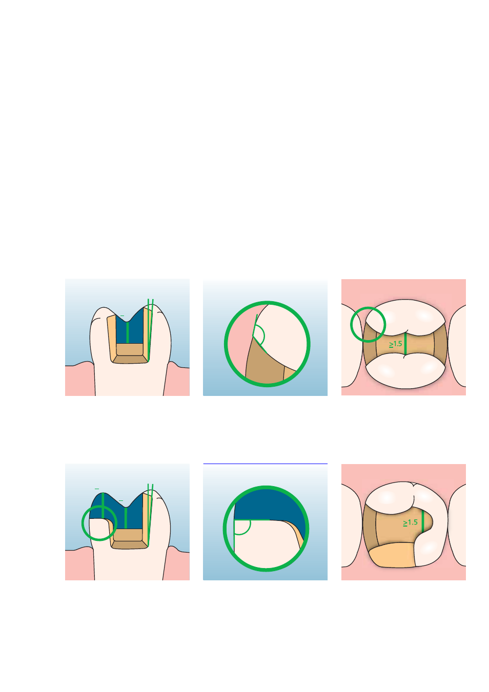 Empress cad, Practical working steps, Preparation guidelines and minimum thicknesses | Ivoclar Vivadent IPS Empress CAD Labside User Manual | Page 17 / 44