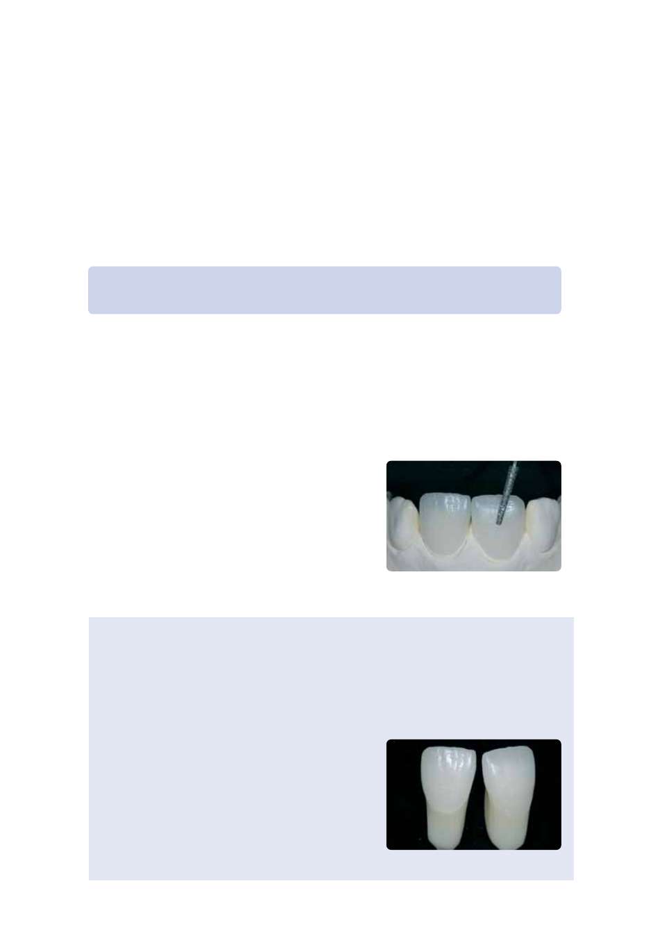 Ips empress cad veneers / crowns – stained/glazed | Ivoclar Vivadent IPS Empress CAD Labside User Manual | Page 25 / 44