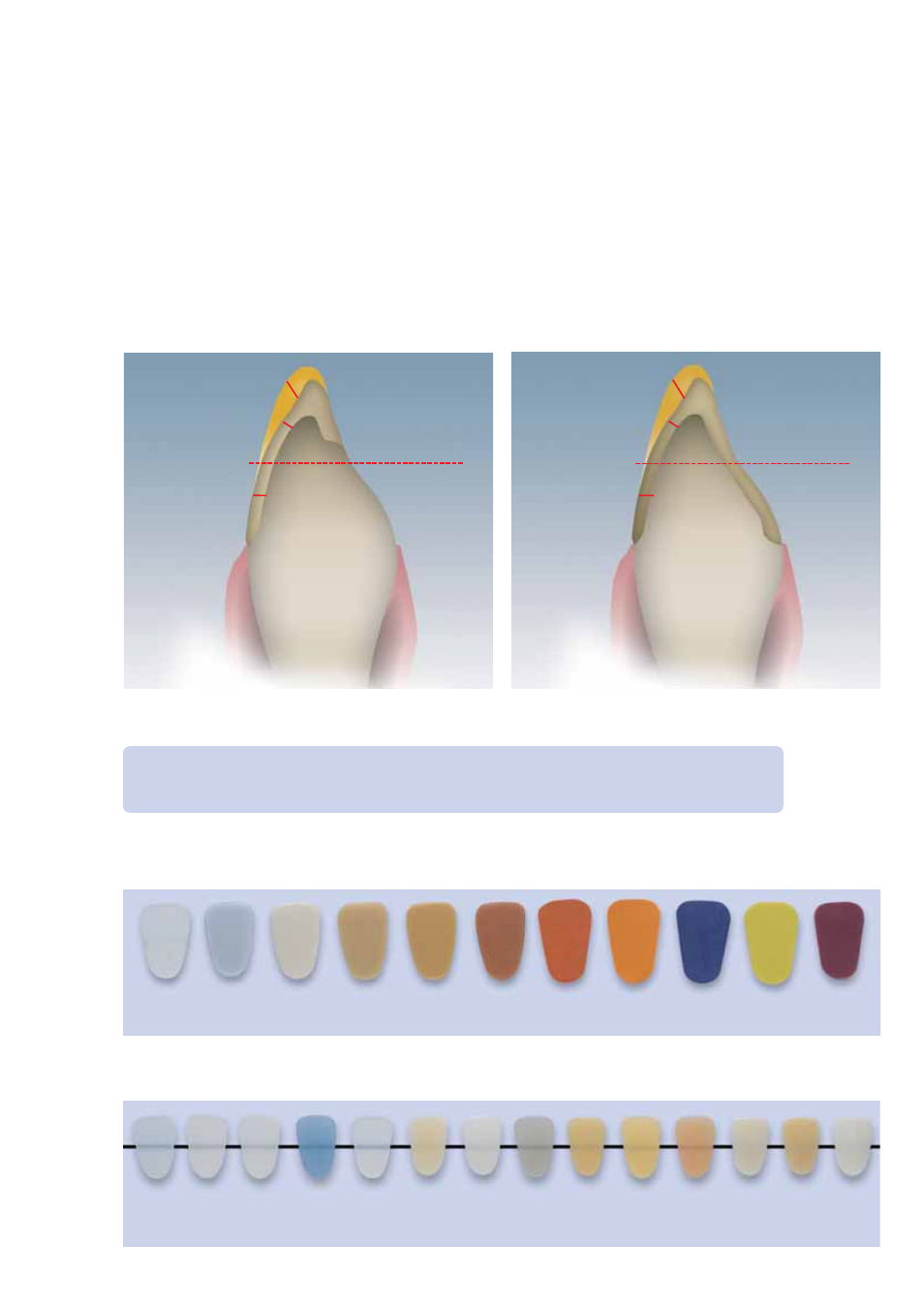 Ivoclar Vivadent IPS Empress CAD Labside User Manual | Page 30 / 44