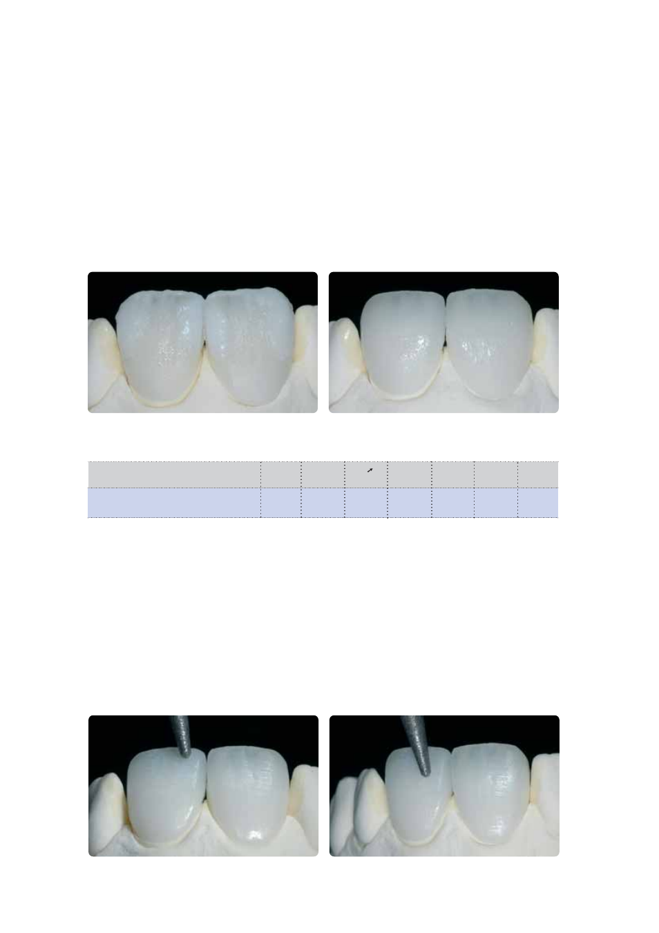 Ivoclar Vivadent IPS Empress CAD Labside User Manual | Page 35 / 44