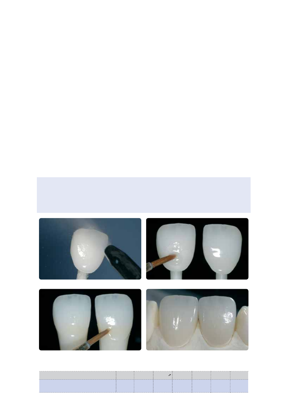 Ivoclar Vivadent IPS Empress CAD Labside User Manual | Page 36 / 44