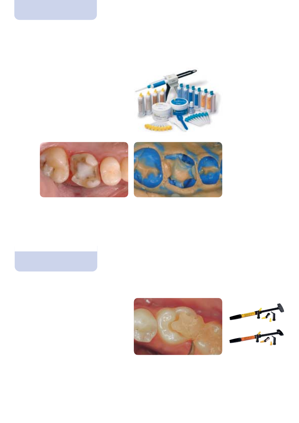 Individual and precise, Impression taking, Temporary restoration | Ivoclar Vivadent IPS Empress Esthetic Clinical User Manual | Page 10 / 28