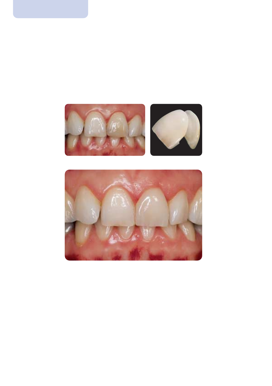 Ivoclar Vivadent IPS Empress Esthetic Clinical User Manual | Page 16 / 28