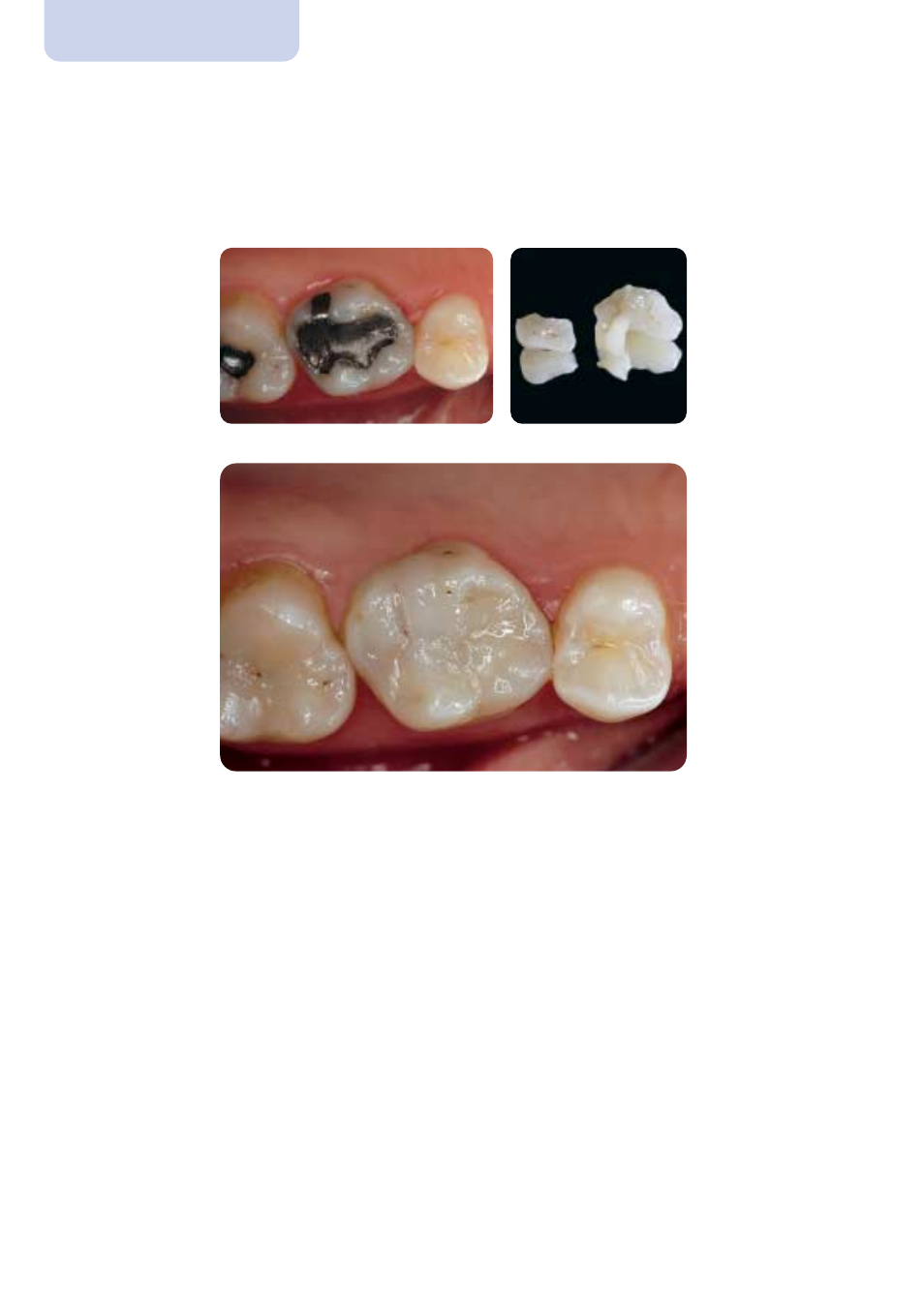 Ivoclar Vivadent IPS Empress Esthetic Clinical User Manual | Page 24 / 28