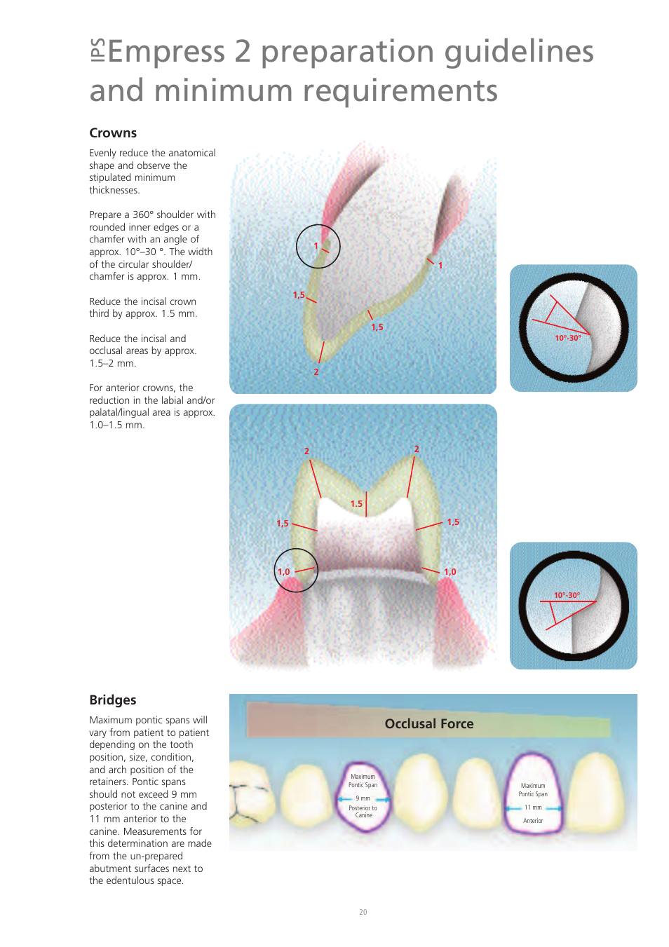 Crowns, Bridges, Occlusal force | Ivoclar Vivadent IPS Eris for E2 User Manual | Page 20 / 48