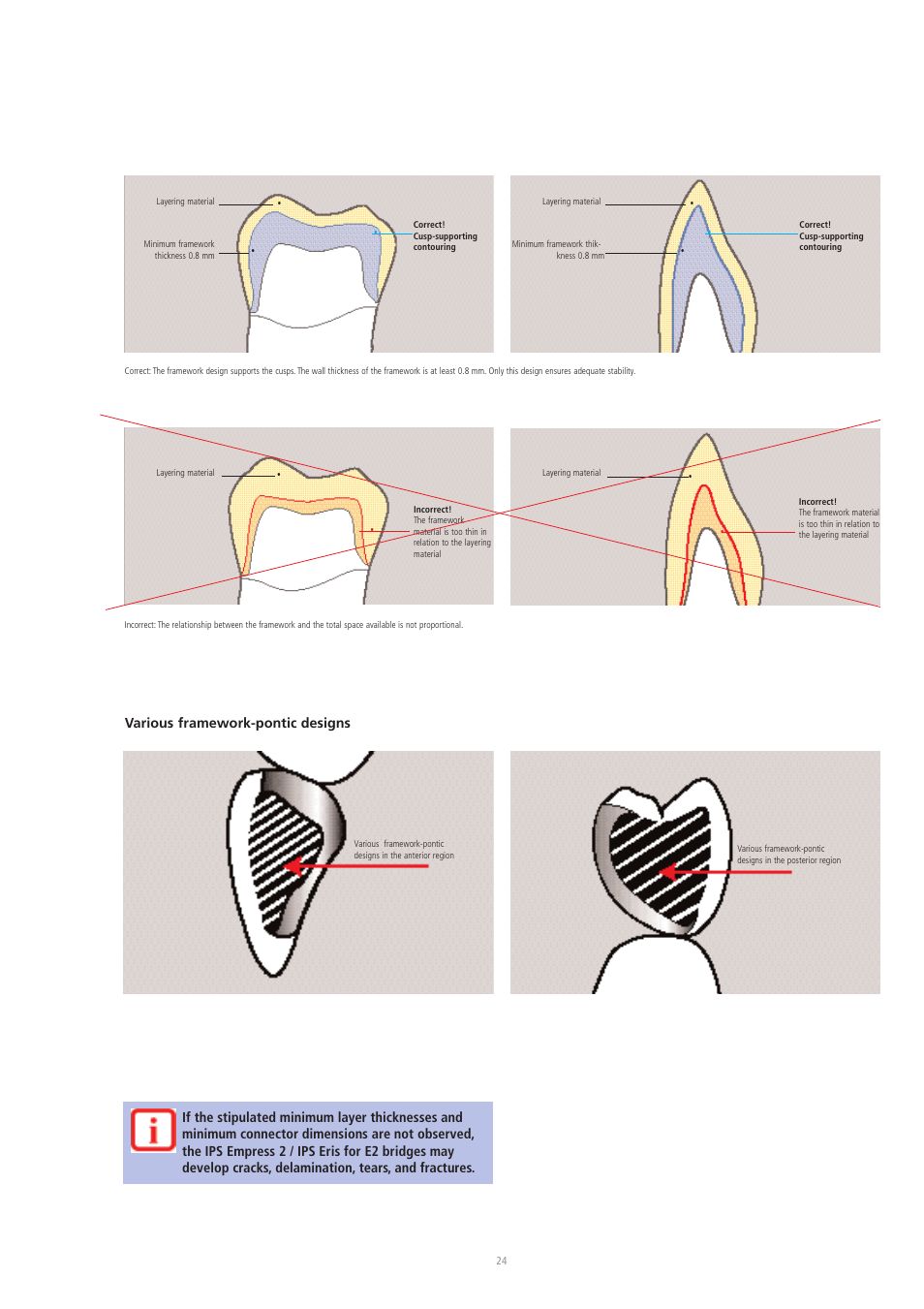 Various framework-pontic designs | Ivoclar Vivadent IPS Eris for E2 User Manual | Page 24 / 48