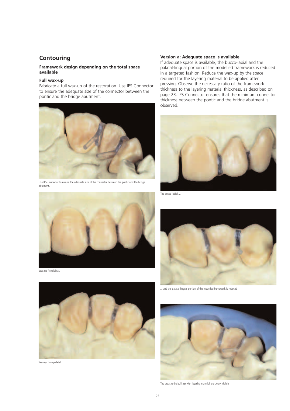 Contouring | Ivoclar Vivadent IPS Eris for E2 User Manual | Page 25 / 48