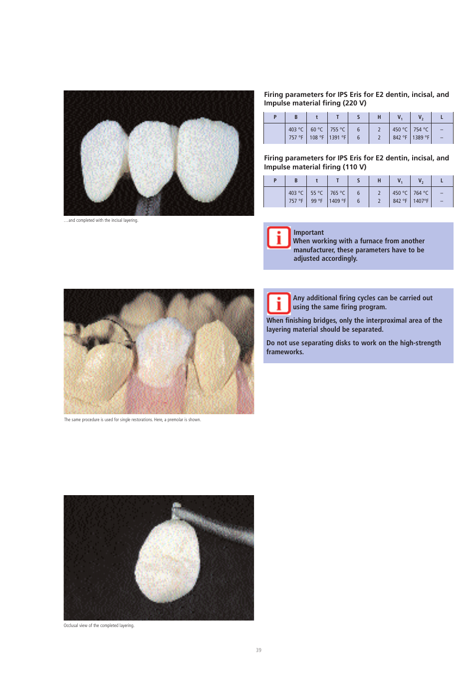 Ivoclar Vivadent IPS Eris for E2 User Manual | Page 39 / 48