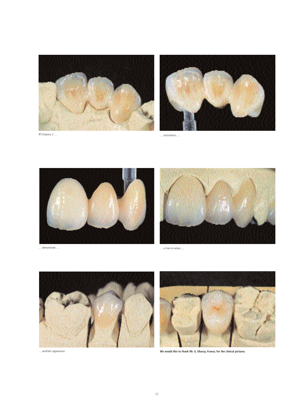 Ivoclar Vivadent IPS Eris for E2 User Manual | Page 42 / 48