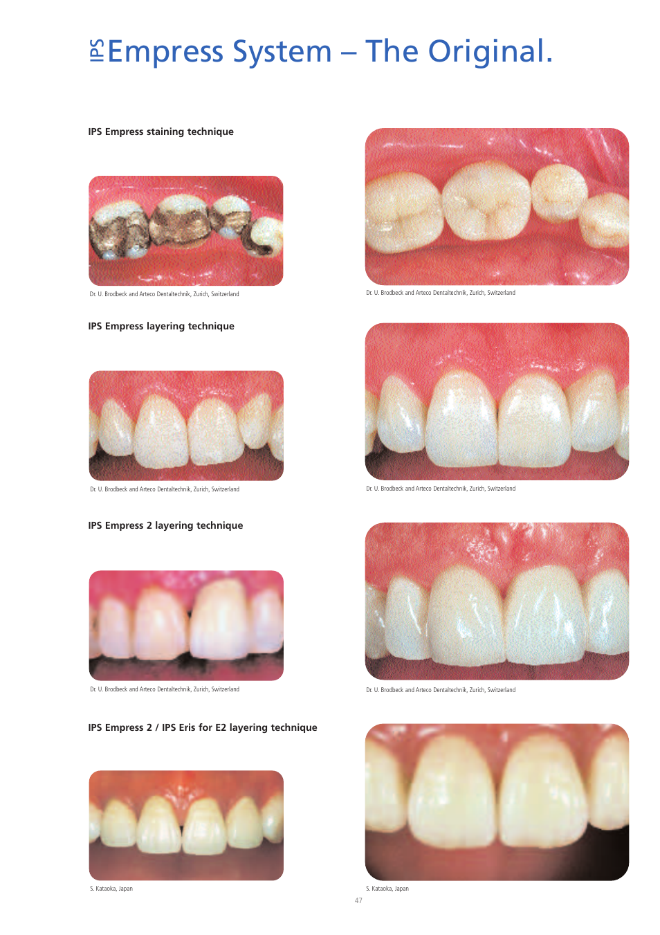 Empress system – the original | Ivoclar Vivadent IPS Eris for E2 User Manual | Page 47 / 48