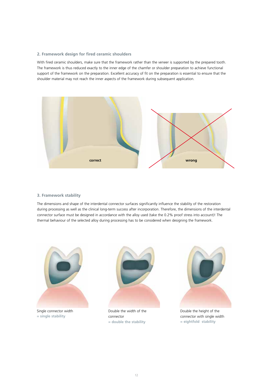 Ivoclar Vivadent IPS InLine System User Manual | Page 12 / 88