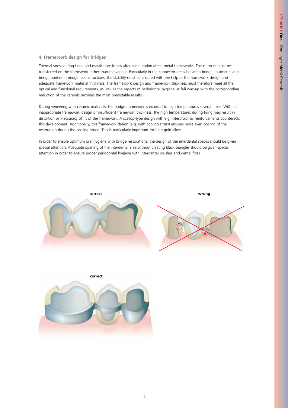 Ivoclar Vivadent IPS InLine System User Manual | Page 13 / 88