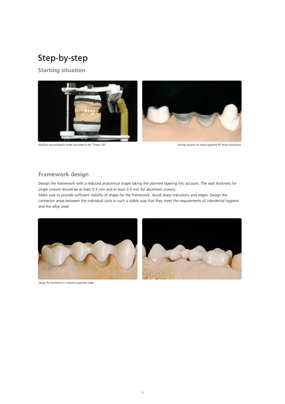 Step-by-step, Starting situation framework design | Ivoclar Vivadent IPS InLine System User Manual | Page 16 / 88