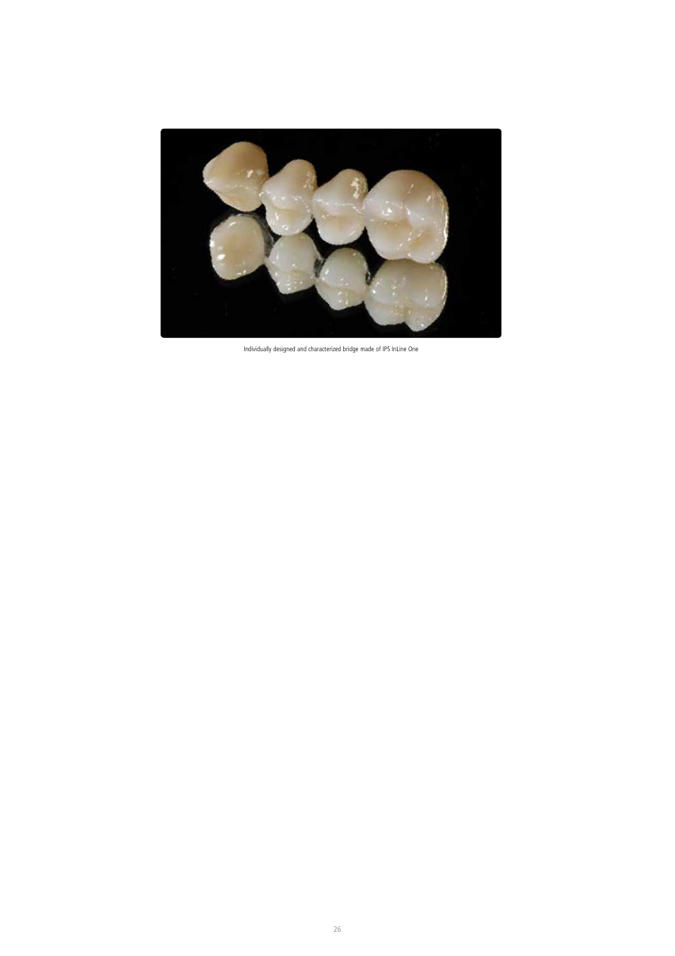 Ivoclar Vivadent IPS InLine System User Manual | Page 26 / 88