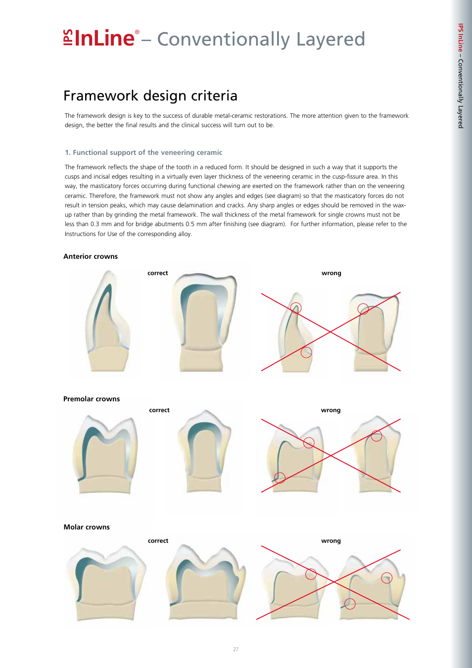 Inline, Conventionally layered, Framework design criteria | Ivoclar Vivadent IPS InLine System User Manual | Page 27 / 88