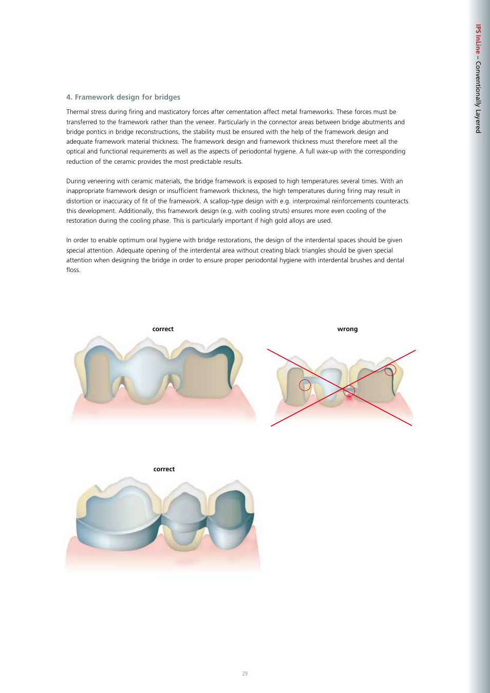 Ivoclar Vivadent IPS InLine System User Manual | Page 29 / 88