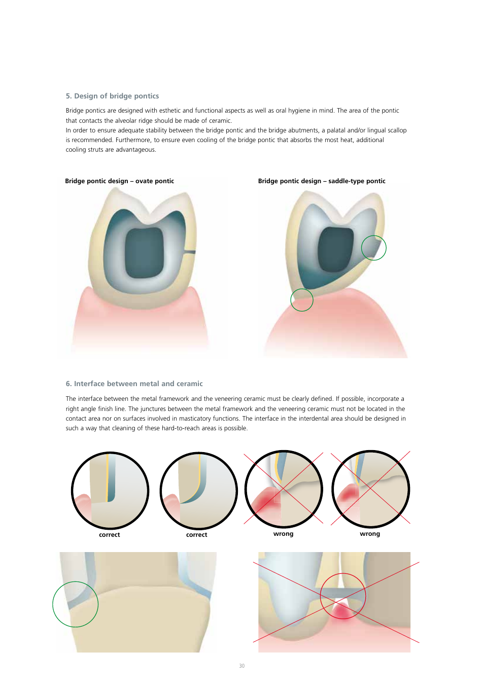 Ivoclar Vivadent IPS InLine System User Manual | Page 30 / 88