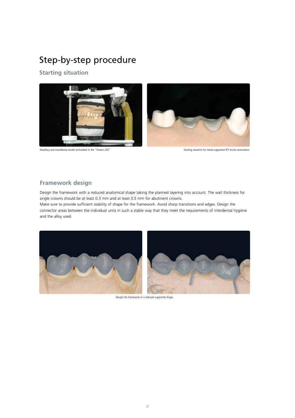 Step-by-step procedure, Starting situation, Framework design | Ivoclar Vivadent IPS InLine System User Manual | Page 32 / 88