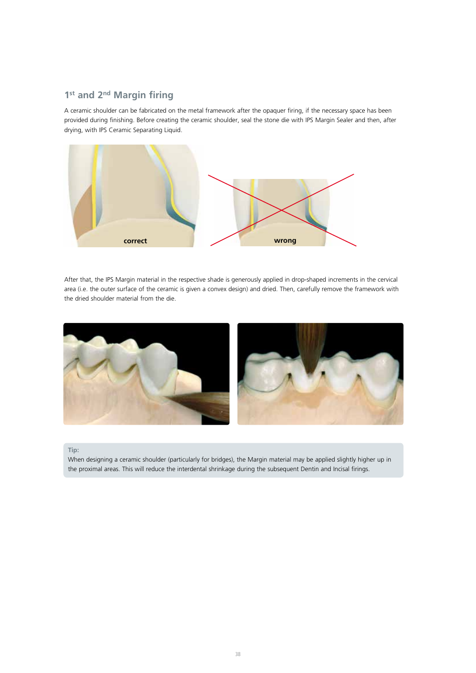And 2, Margin firing | Ivoclar Vivadent IPS InLine System User Manual | Page 38 / 88