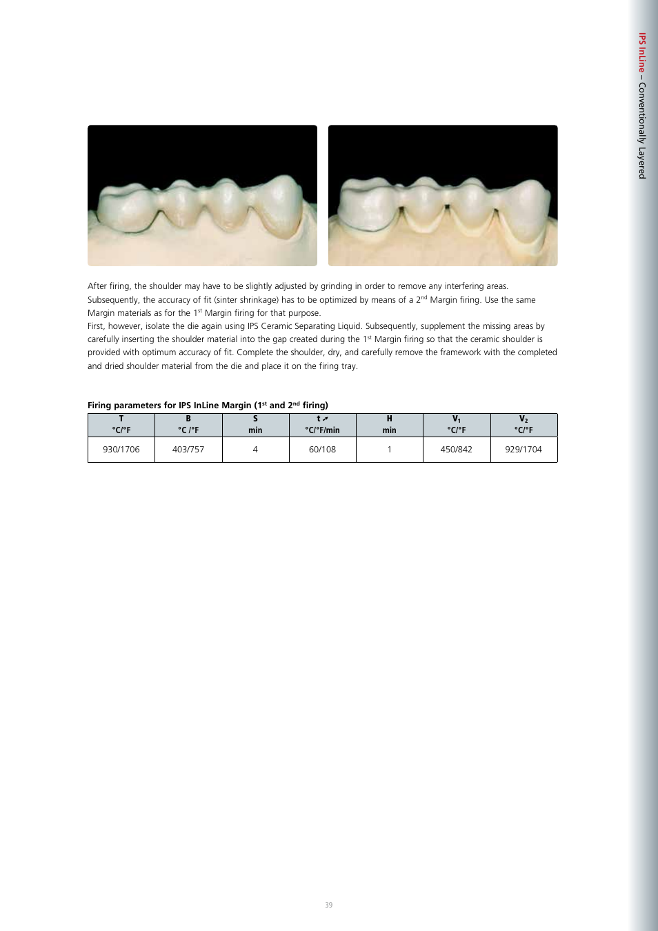 Ivoclar Vivadent IPS InLine System User Manual | Page 39 / 88