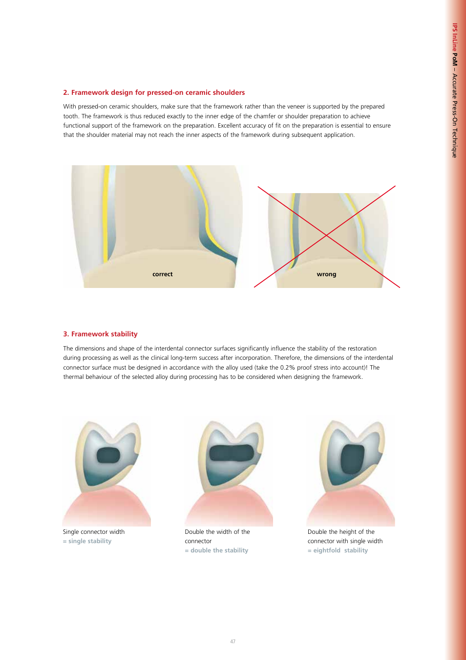 Inline, Accurate press-on technique | Ivoclar Vivadent IPS InLine System User Manual | Page 47 / 88