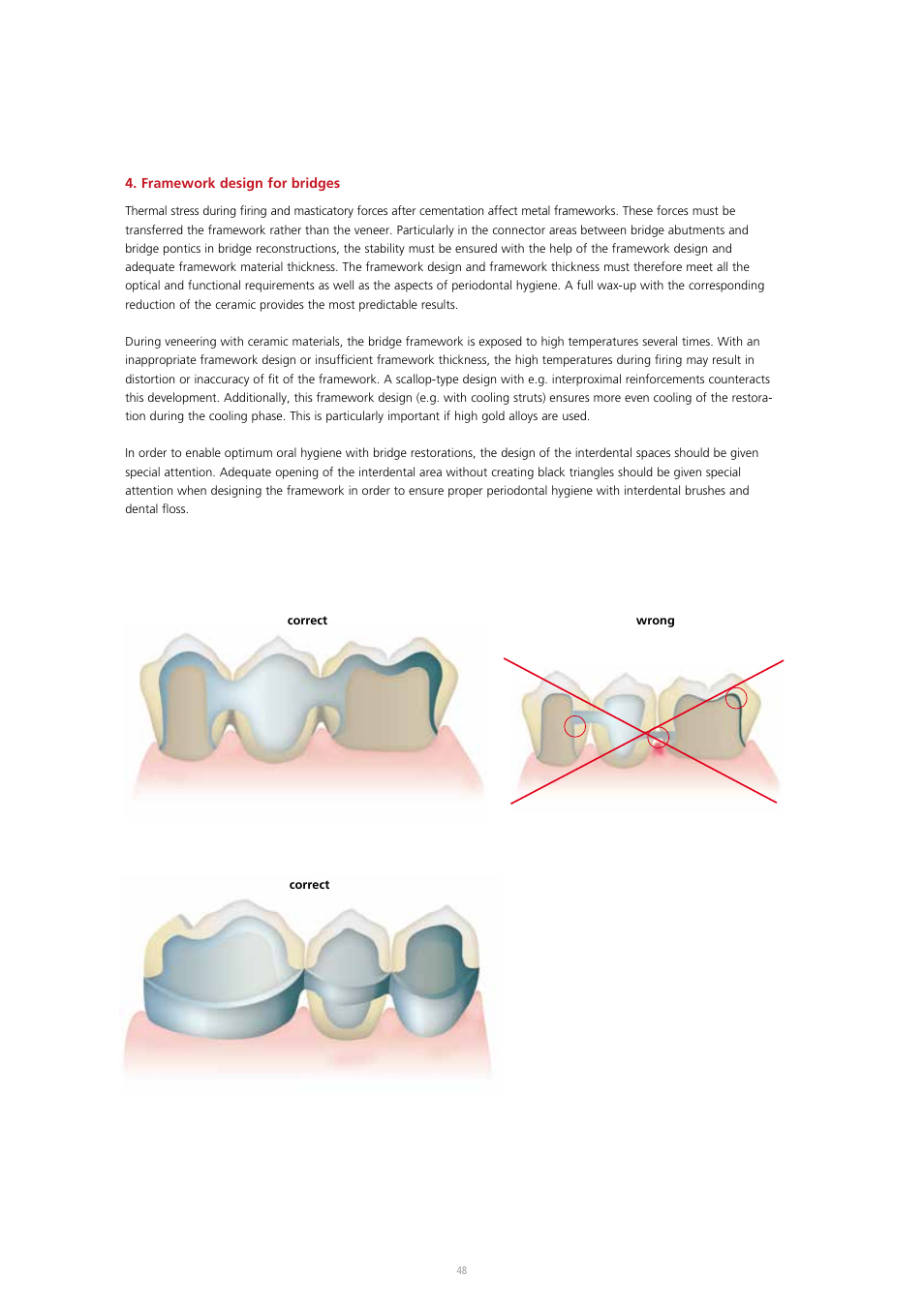 Ivoclar Vivadent IPS InLine System User Manual | Page 48 / 88