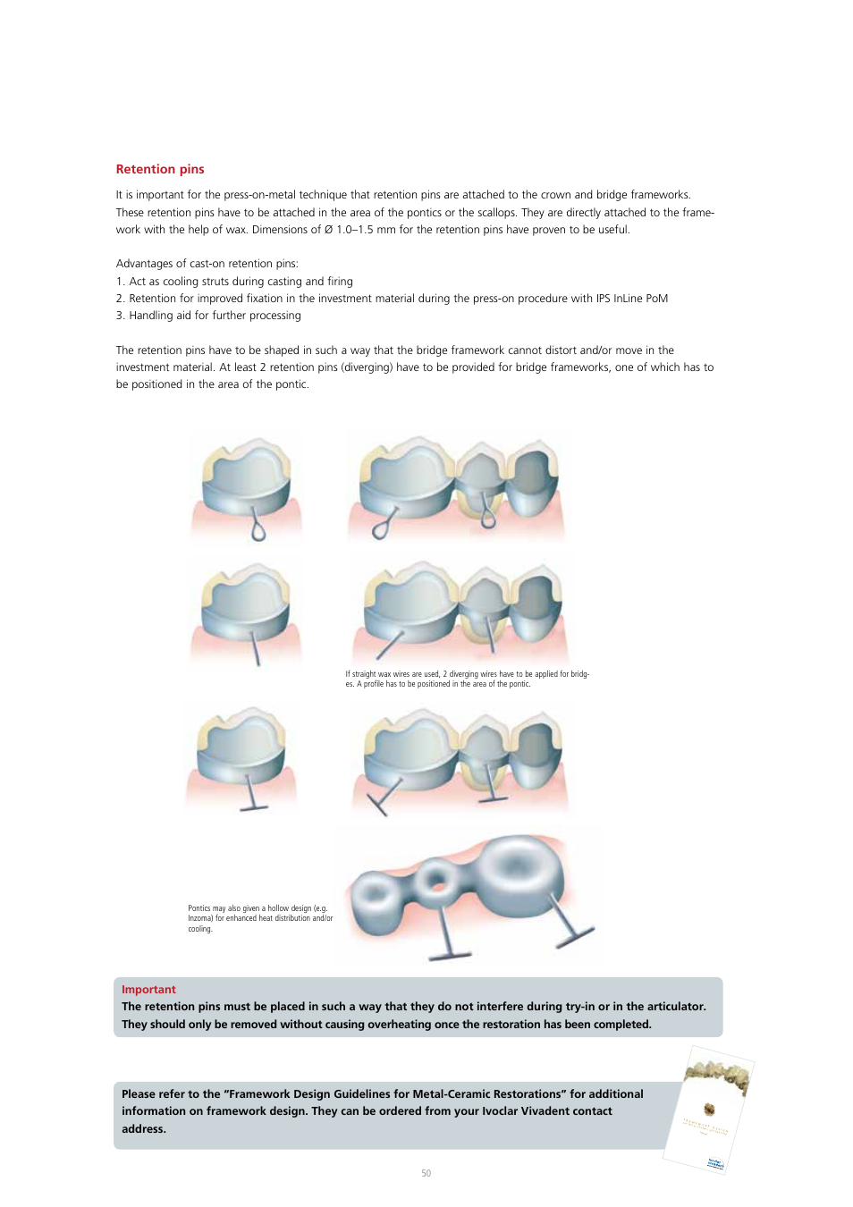 Retention pins | Ivoclar Vivadent IPS InLine System User Manual | Page 50 / 88