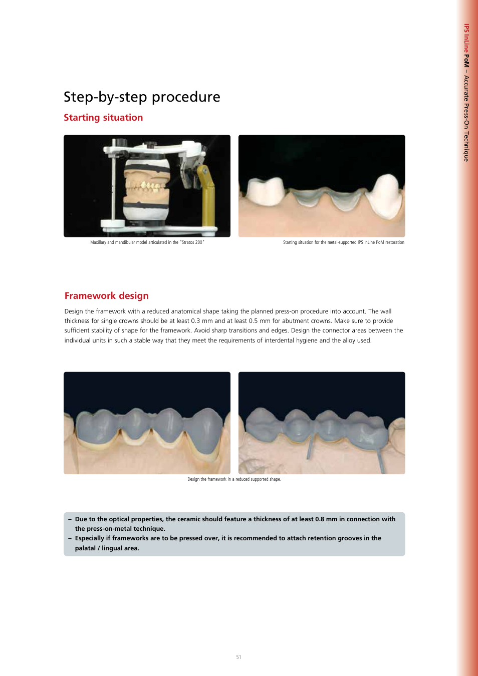 Step-by-step procedure, Starting situation, Framework design | Ivoclar Vivadent IPS InLine System User Manual | Page 51 / 88