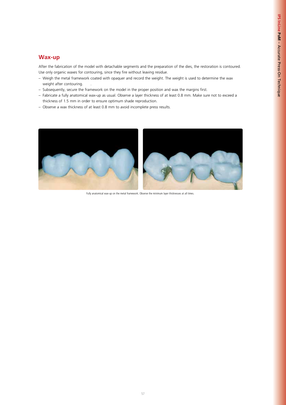 Wax-up | Ivoclar Vivadent IPS InLine System User Manual | Page 57 / 88