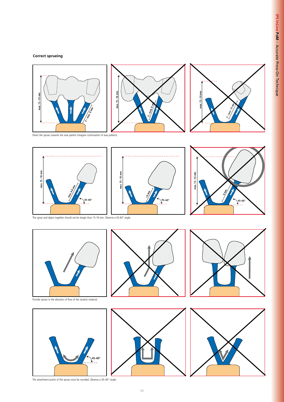 Ivoclar Vivadent IPS InLine System User Manual | Page 59 / 88