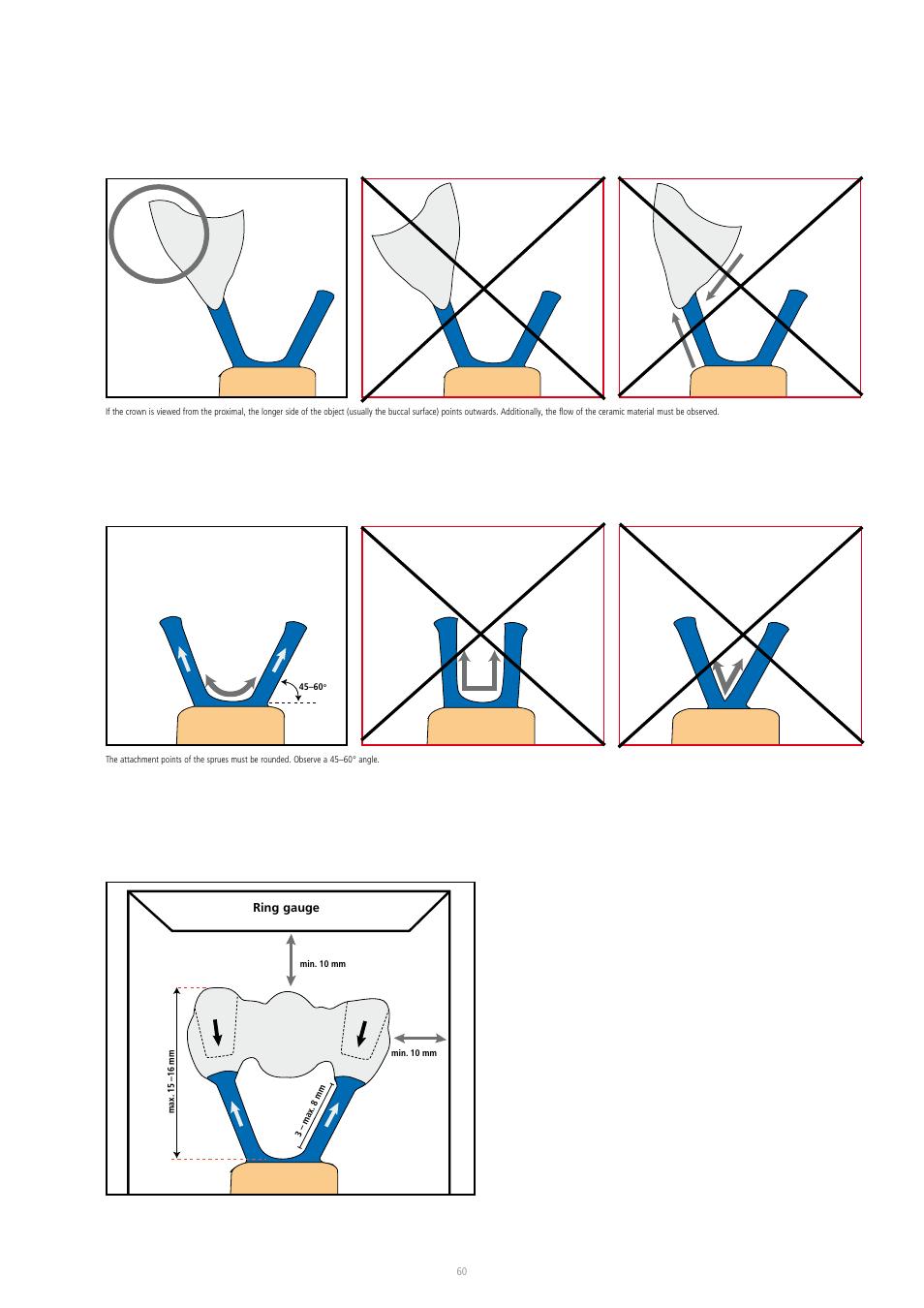 Ivoclar Vivadent IPS InLine System User Manual | Page 60 / 88