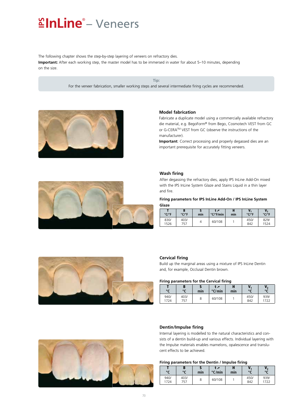 Inline, Veneers | Ivoclar Vivadent IPS InLine System User Manual | Page 70 / 88
